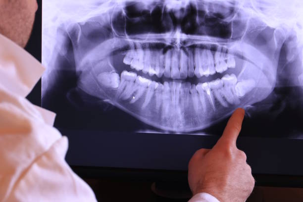 Best Emergency Dental Services for Seniors in Russiaville, IN