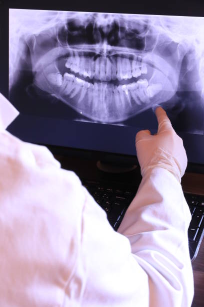 Best Emergency Dentist for Lost Fillings or Crowns in Russiaville, IN