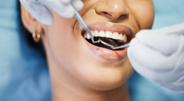 Best Emergency Root Canal Treatment in Russiaville, IN