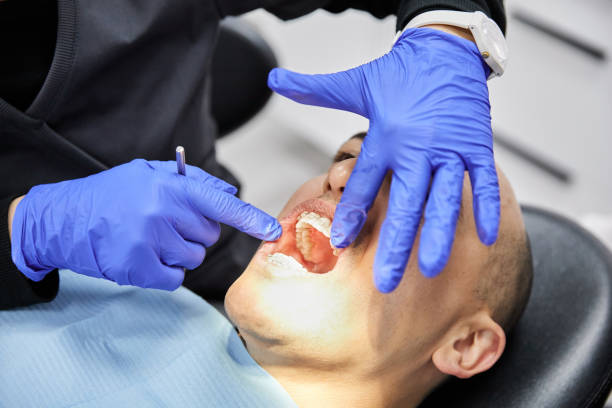 Best Emergency Dentist for Knocked-Out Tooth in Russiaville, IN